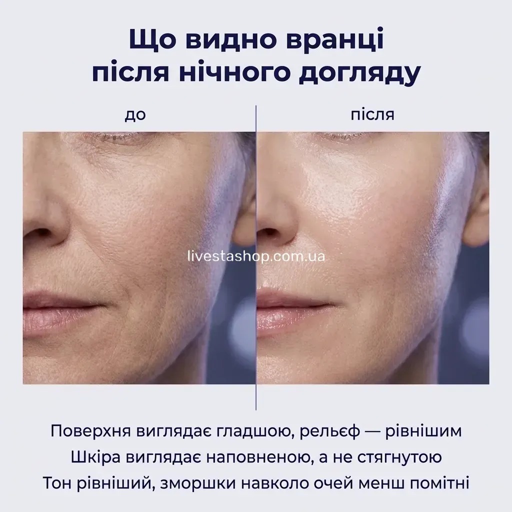 Як діє нічний крем CollagenaT — гладша поверхня, наповнена шкіра й рівніший тон вранці