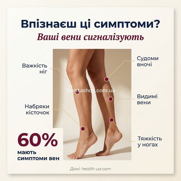 Симптоми венозної недостатності &mdash; важкість ніг, набряки, видимі вени. Flebostax, livestashop